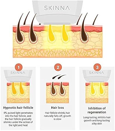 IPL Hair Removal System - Permanent Laser Hair Removal at Home for Face, Body, Bikini Line - Hair Removal Device for Painless Hair Reduction in Women and Men