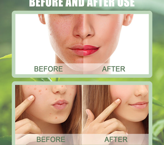 Green Tea Mask Stick for Acne and Blackhead Removal
